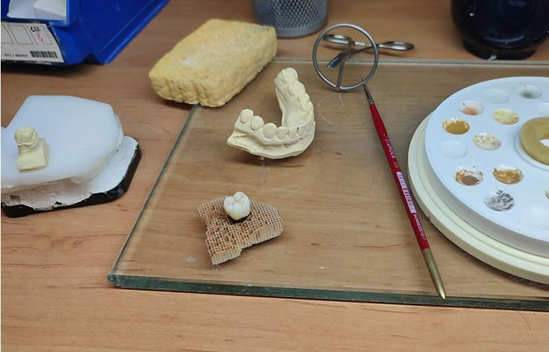 mesa de trabajo con material de prótesis dentales